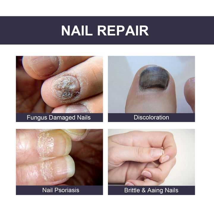 Nail Repair Essence for Smoother, Healthier-Looking Nails