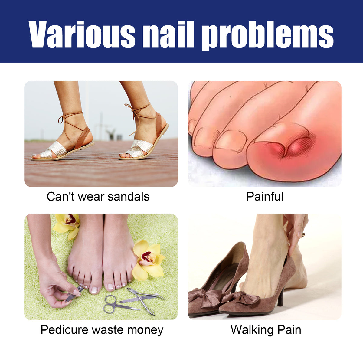 Nail Repair Solution for Gentle Ingrown Toenail Relief
