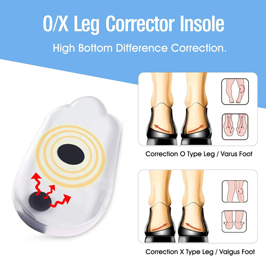 O/X Leg Corrector Insoles — Visible Leg Straightening