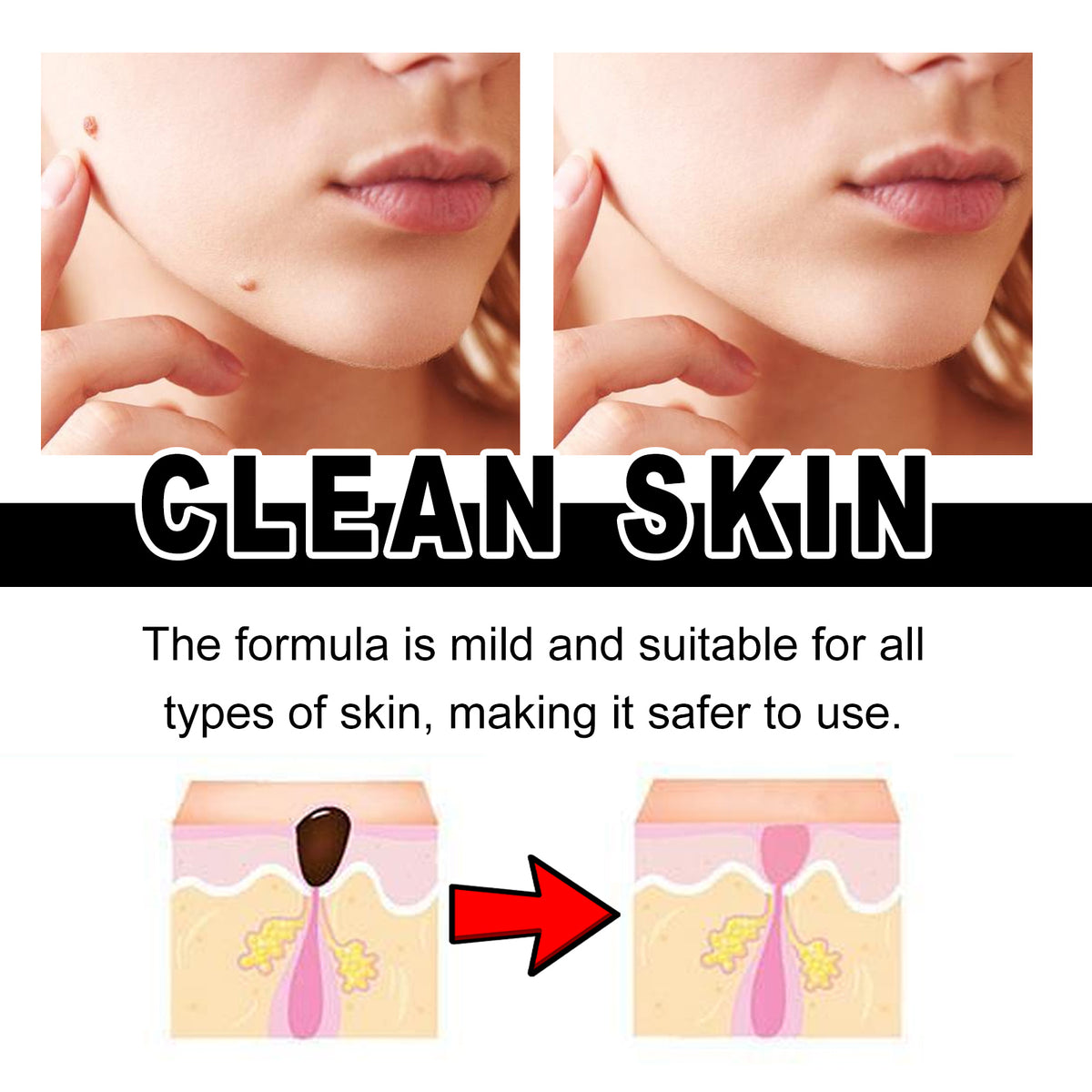 Targeted At-Home Spot Care Essence