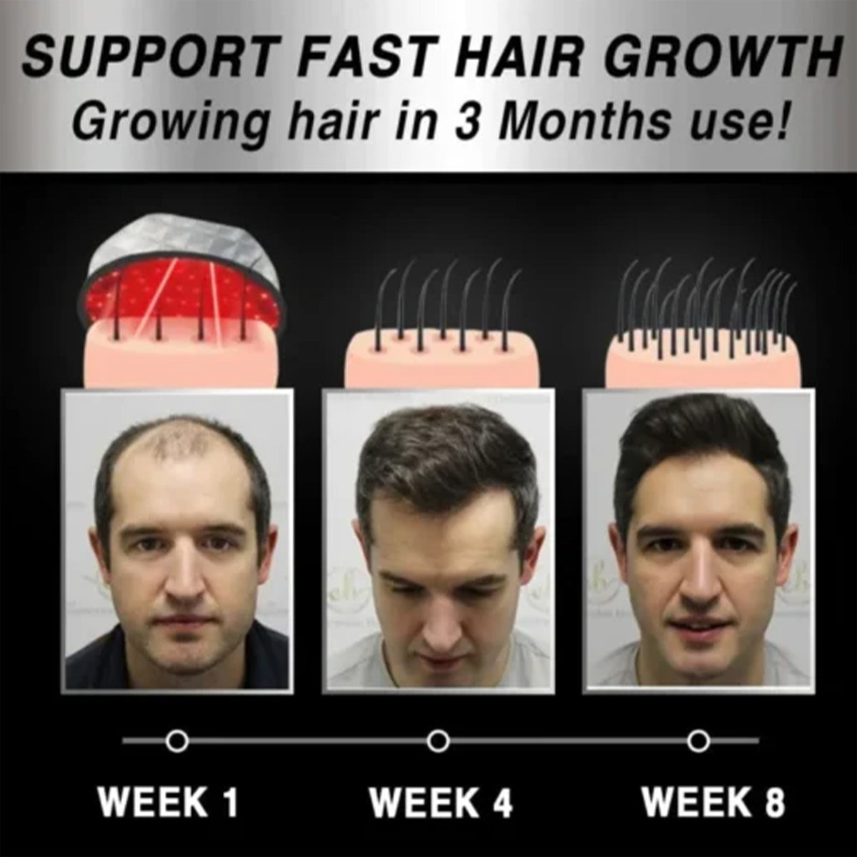 Laser Hair Growth Cap for Easier At-Home Scalp Care