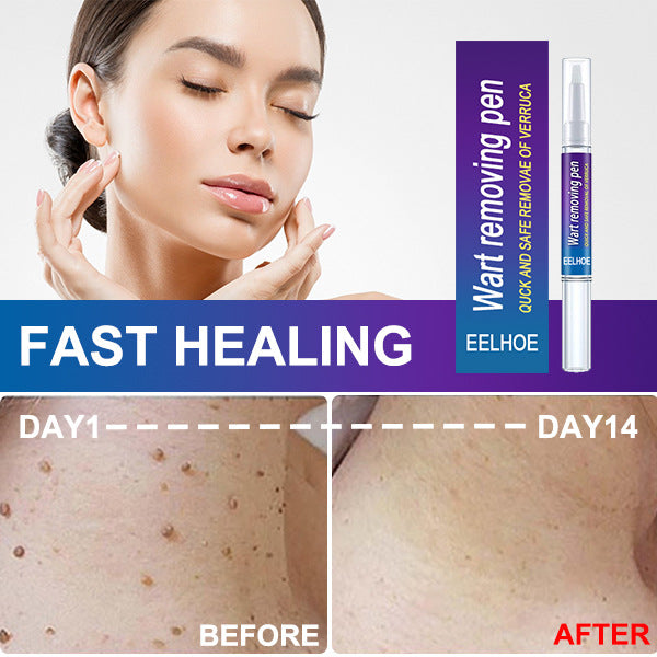 Convenient At-Home Spot Care Pen