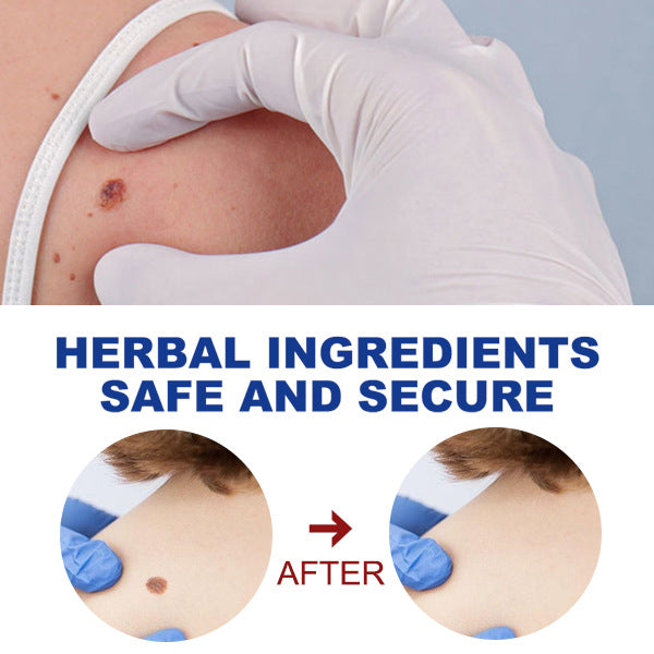 Convenient At-Home Spot Care Pen