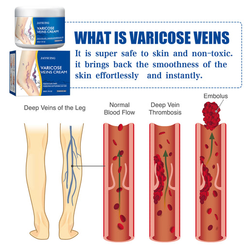 Varicose Vein Relief Cream — Visible Results, Soothes Leg
