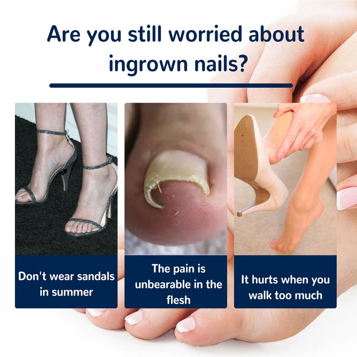 Toenail Correction Patches — Gentle Ingrown Relief