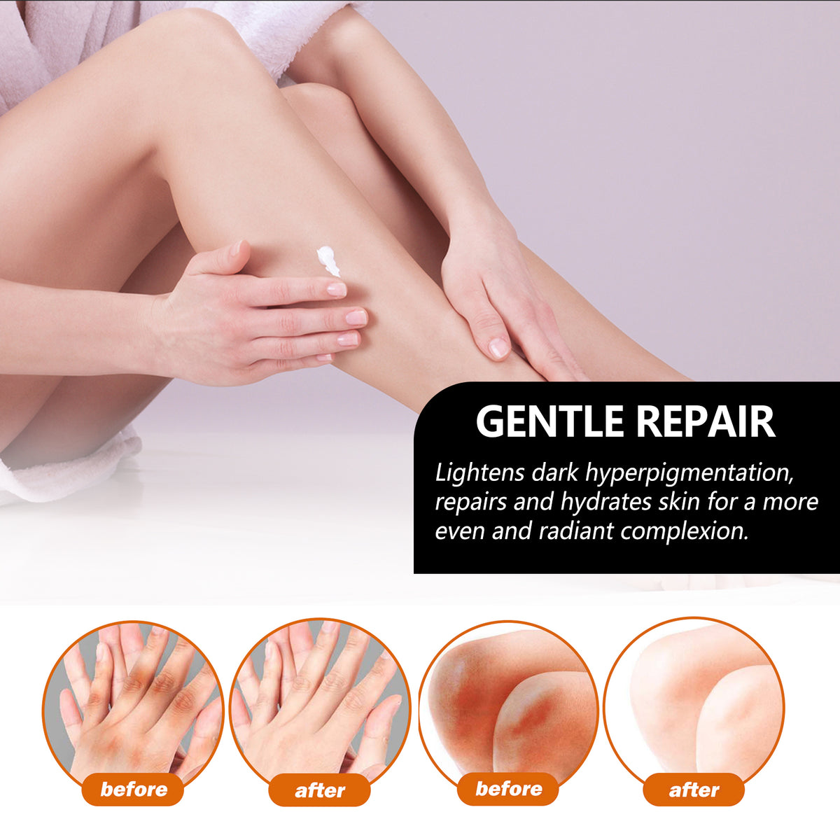 Underarm Whitening Antibacterial Soap – Fades Dark Spots