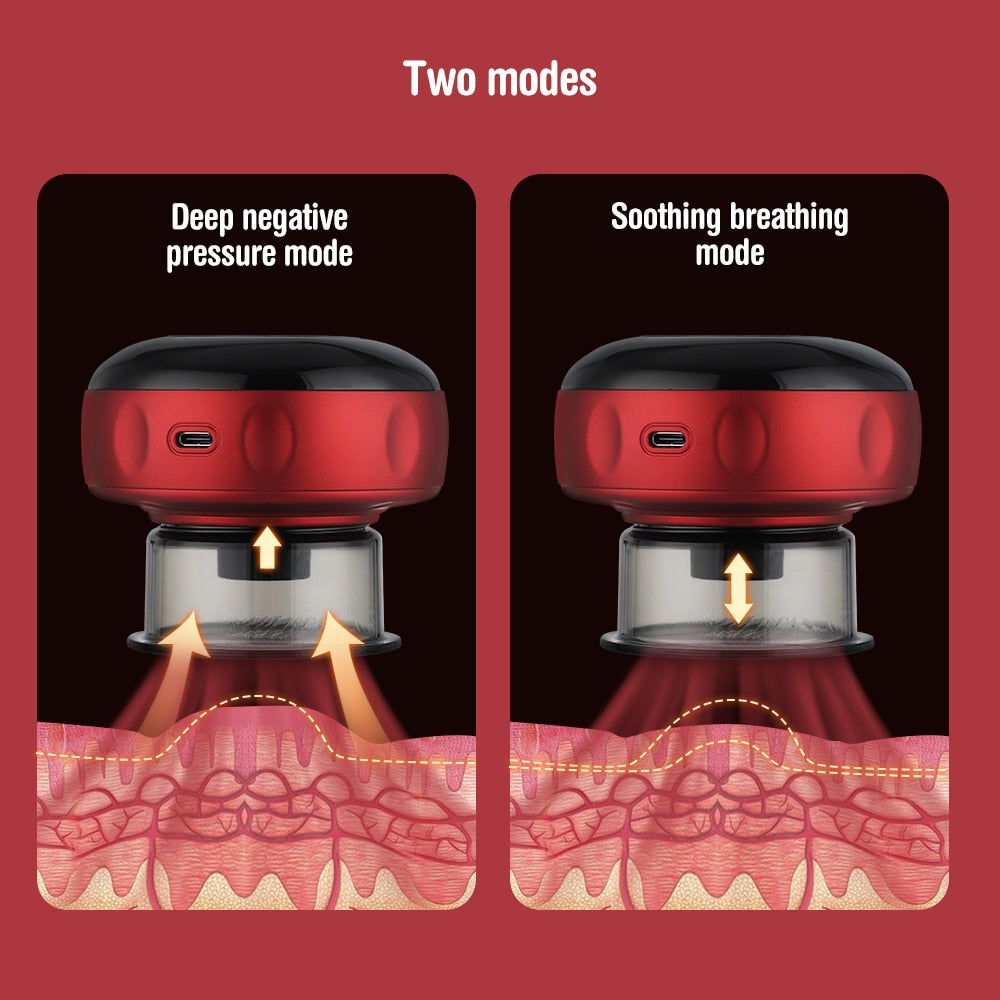 Electric Cupping Massager — Pain Relief & Deep Tissue