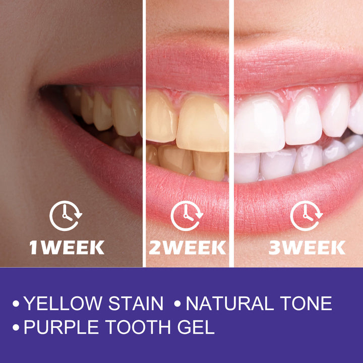 Purple Whitening Toothpaste for Brighter-Looking Teeth
