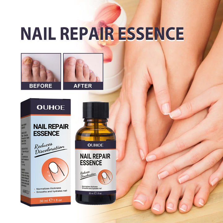 Nail Repair Essence for Smoother, Healthier-Looking Nails