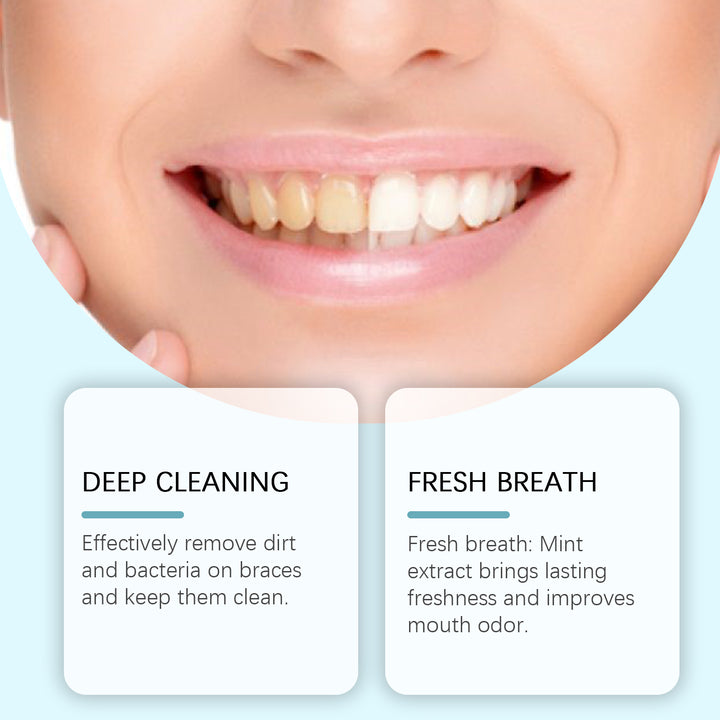 Aligner Cleaner Mousse for a Fresh, Brighter Smile