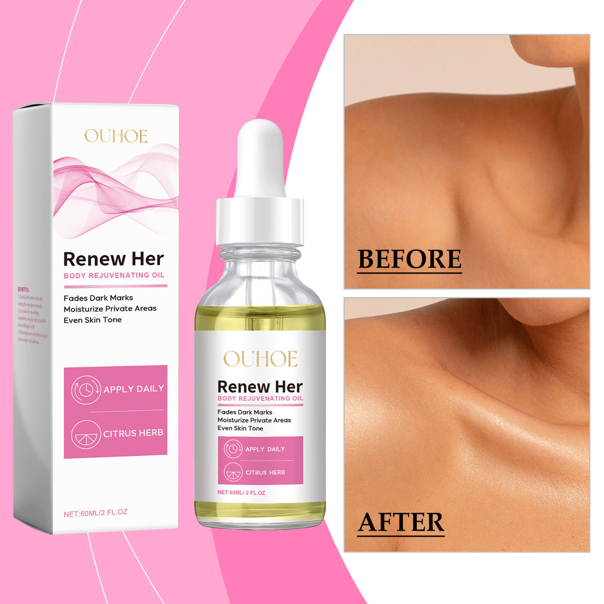 Brightening Body Oil for Radiant, Even Skin Tone