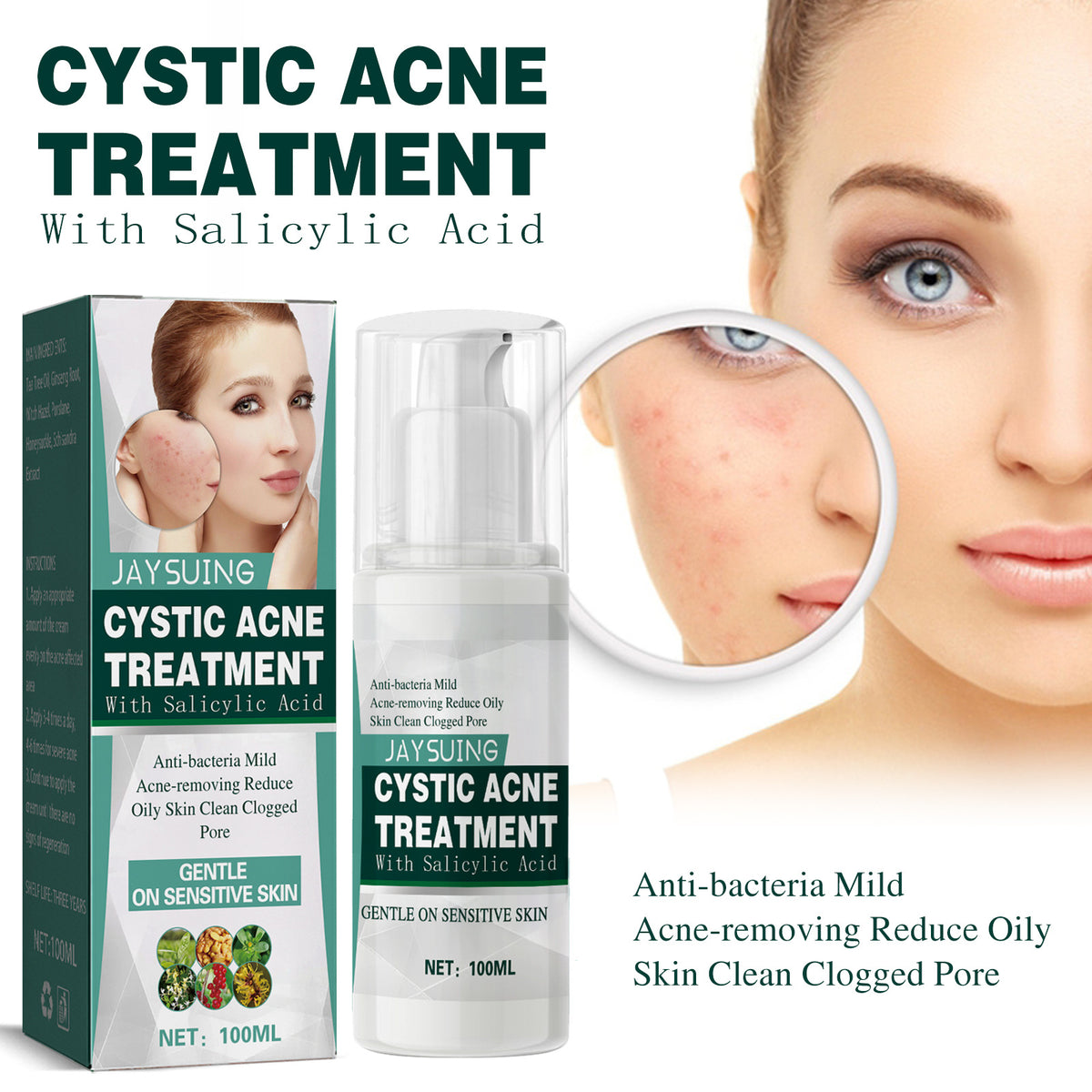 Cystic Acne Cream With Salicylic Acid For Clogged Pores