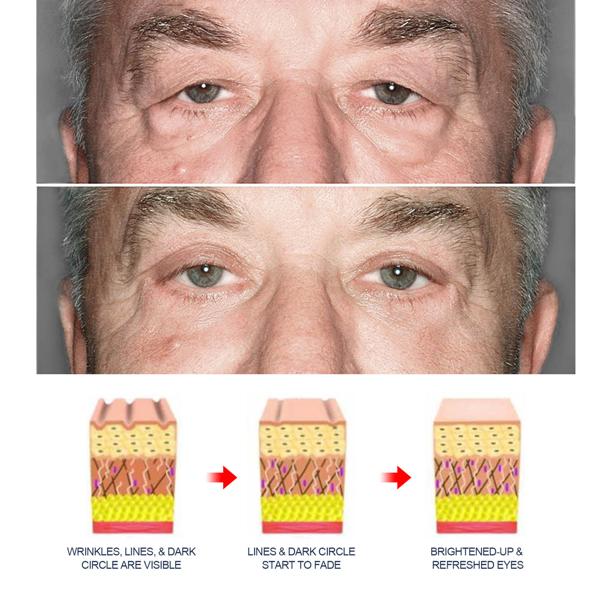 Men's Retinol Eye Cream — Wake Up Looking Rested, Firmer