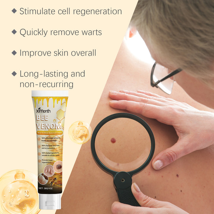 Wart and Skin Tag Cream for Careful At-Home Care
