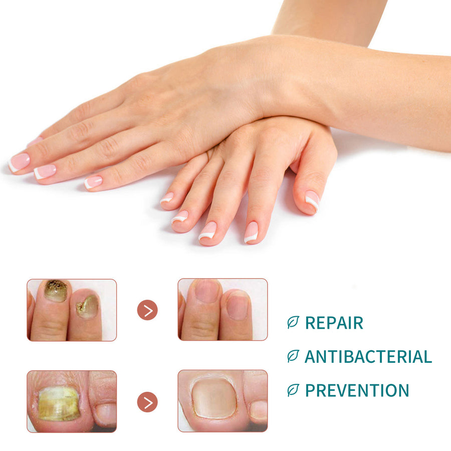 Nail Repair Patches for Smoother, Brighter-Looking Nails