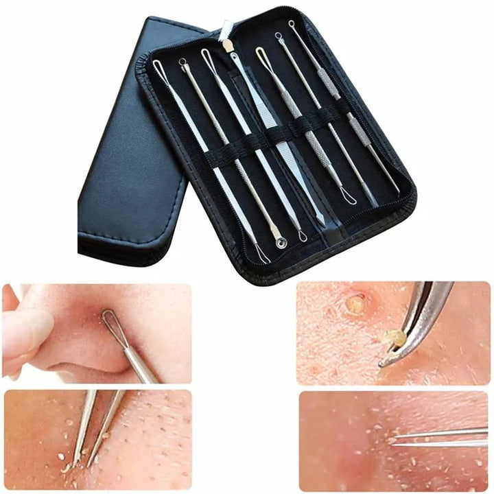 Pimple Extractor Tool — 7‑Piece Precision Acne Removal Set