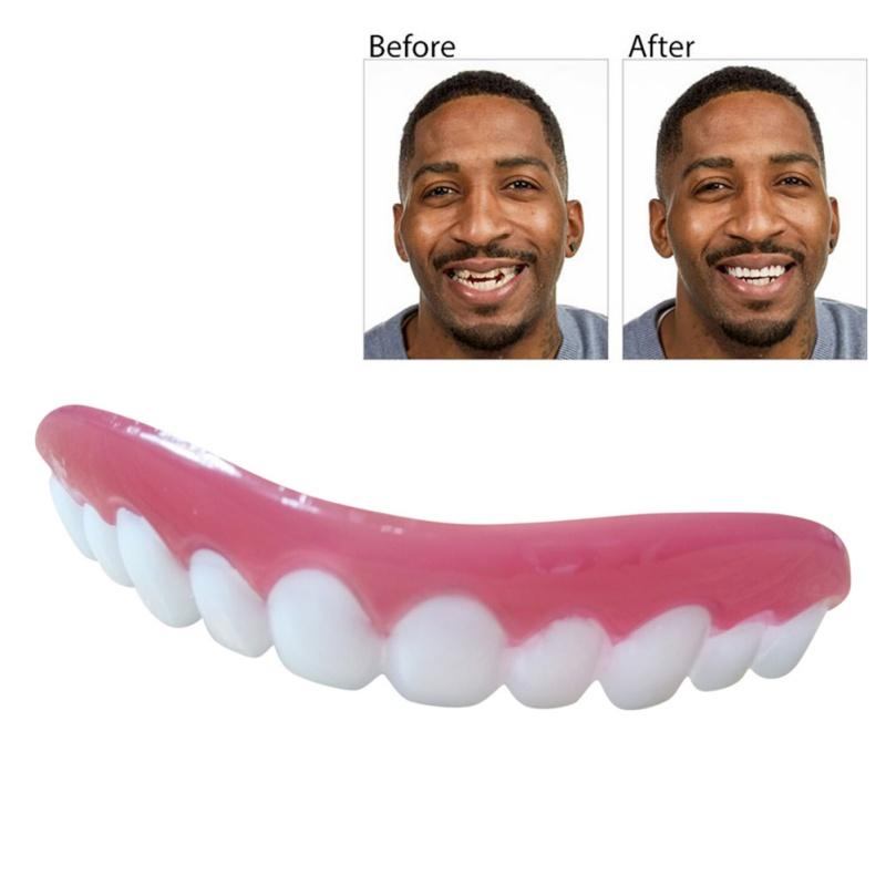 Instant Smile Veneers — Perfect Teeth in Seconds, No Dentist
