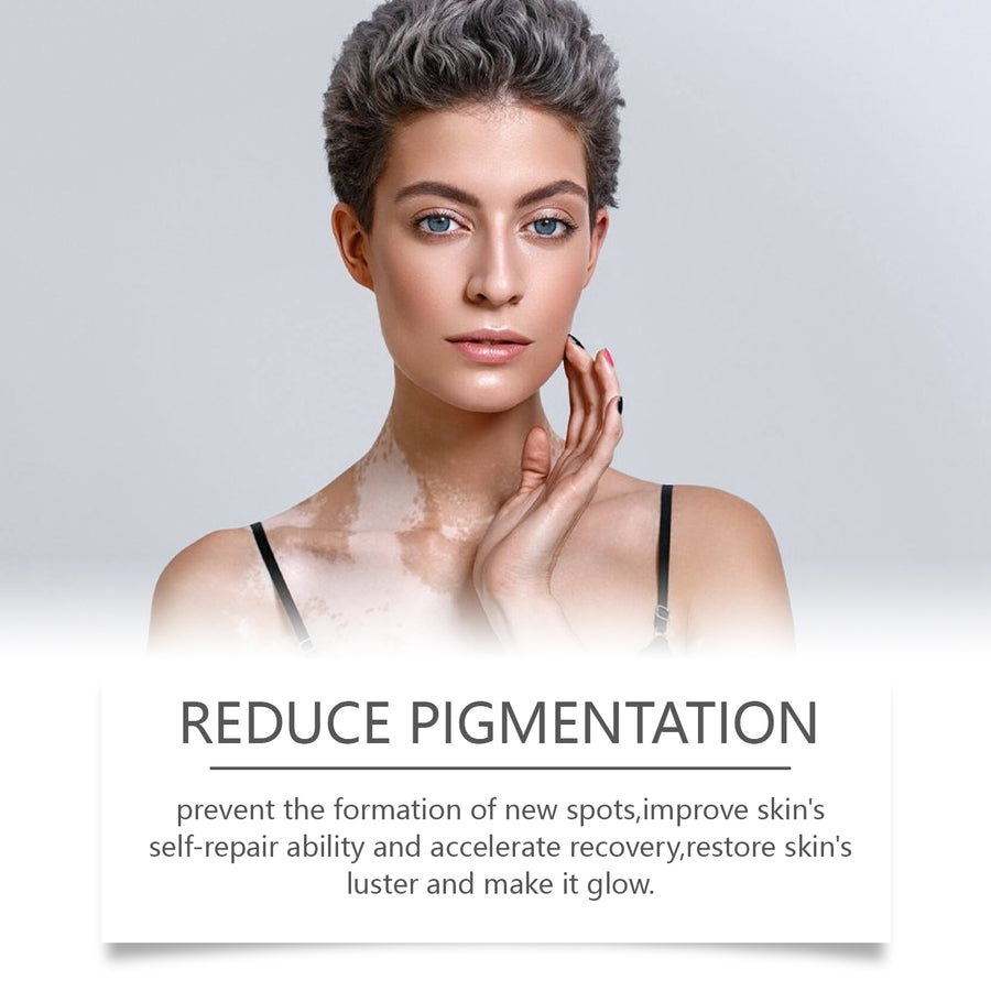 Bee Venom Skin Tone Cream for Uneven Pigmentation