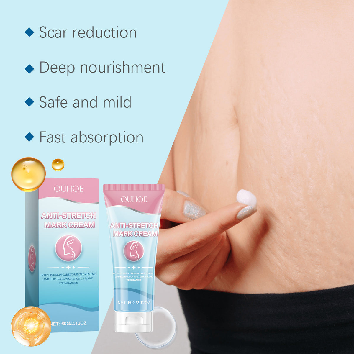 Pregnancy Stretch Mark Cream for Smooth, Moisturized Skin