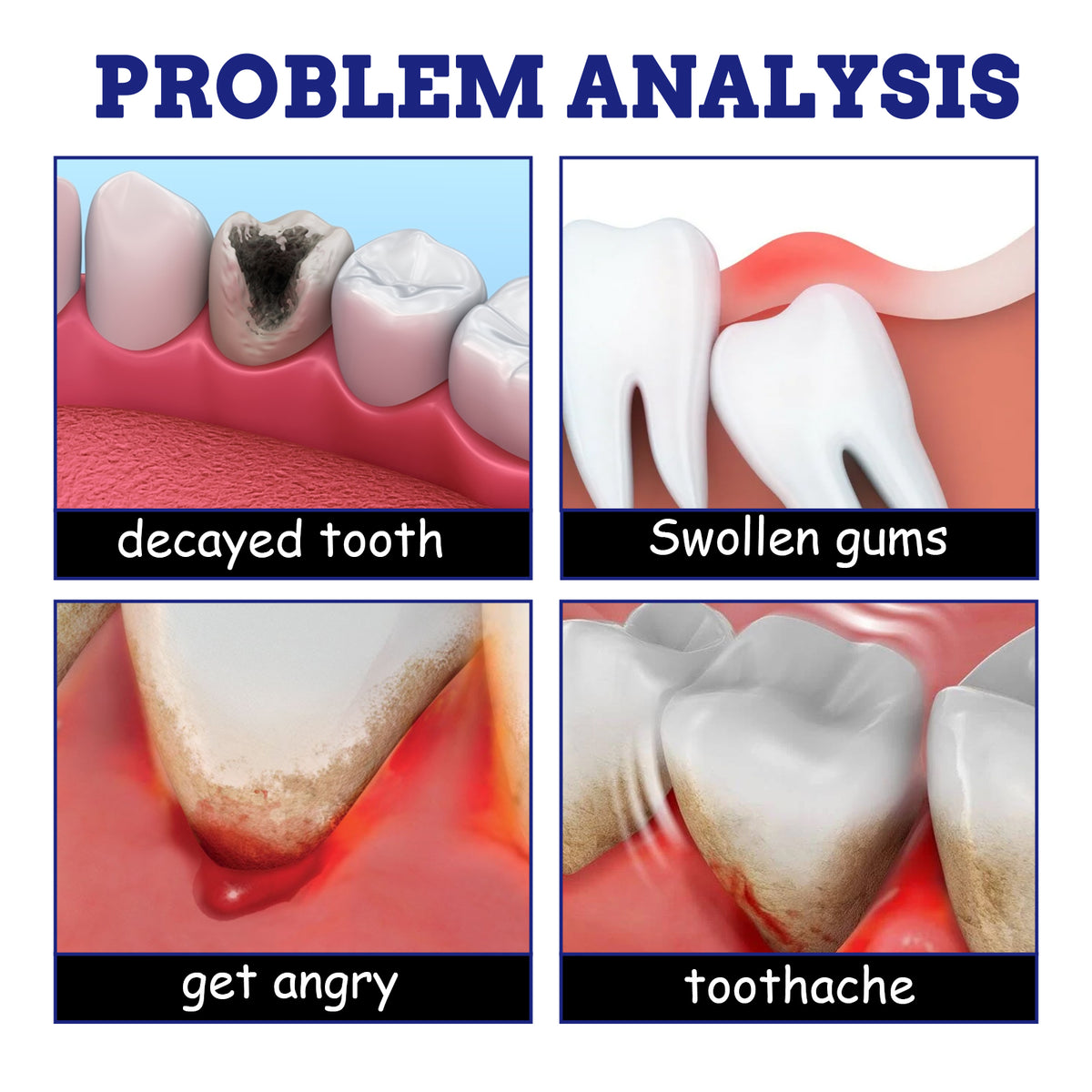 Oral Care Spray for Targeted Toothache and Gum Relief