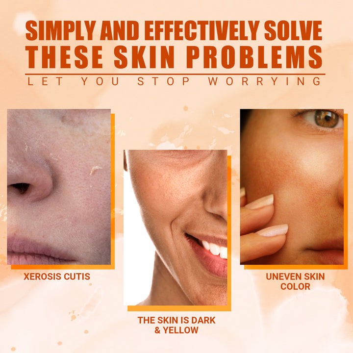 Vitamin C Hydrating Face Mist – Fade Acne Spots & Brighten