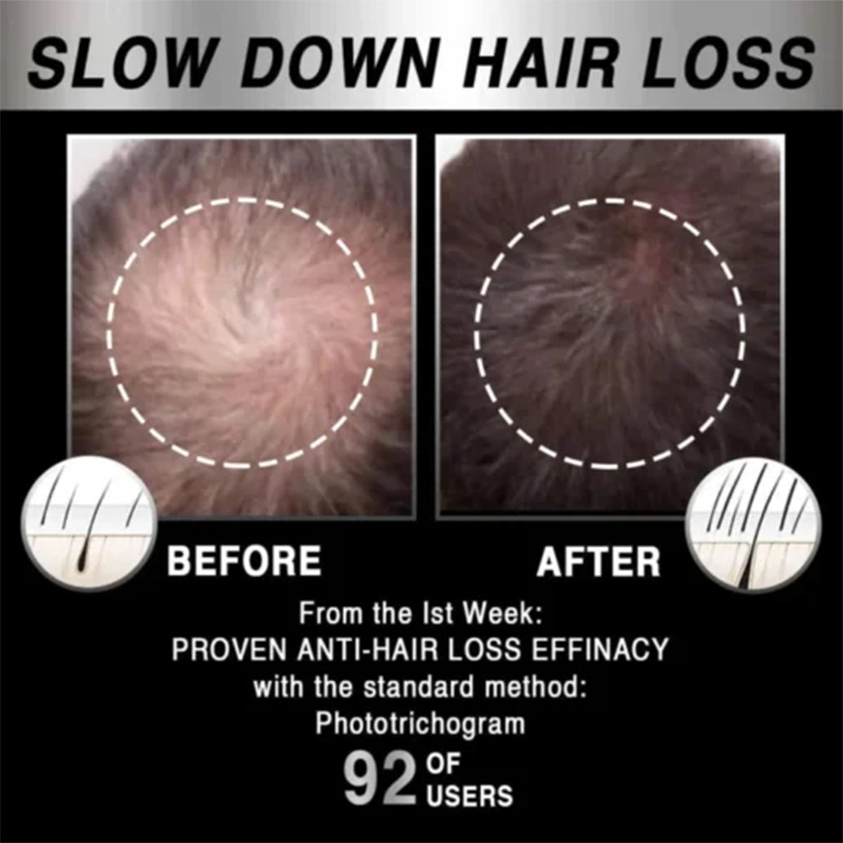 Laser Hair Growth Cap for Easier At-Home Scalp Care