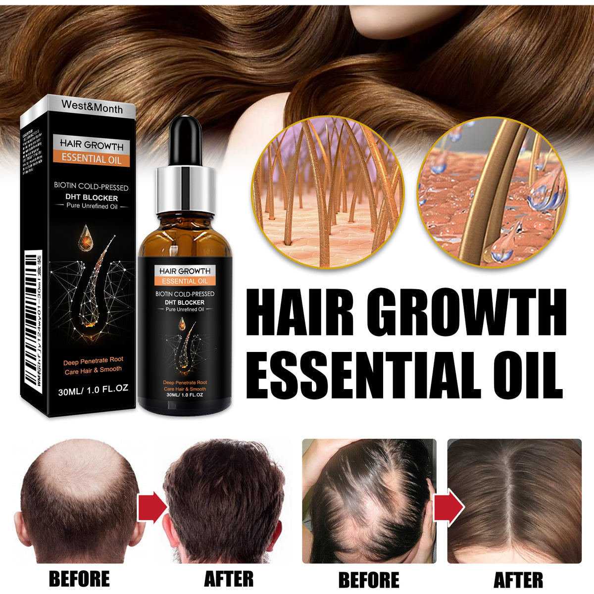 Biotin Hair Growth Oil for Dry Hair and Scalp Care