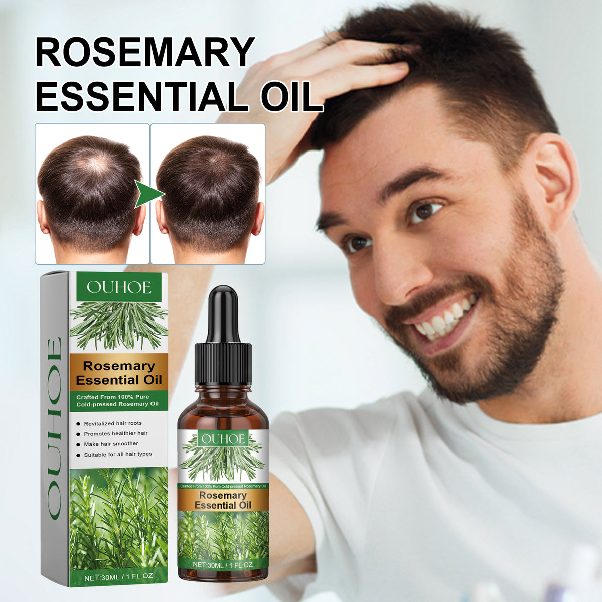 Rosemary Hair Oil for Healthier-Looking Hair Roots
