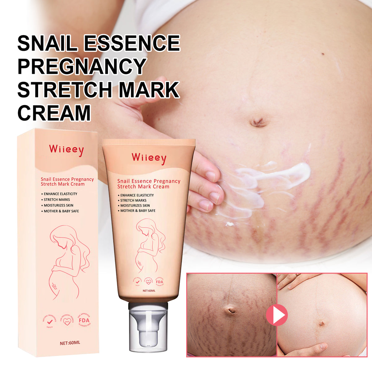 Pregnancy Stretch Mark Cream for Elasticity & Moisture