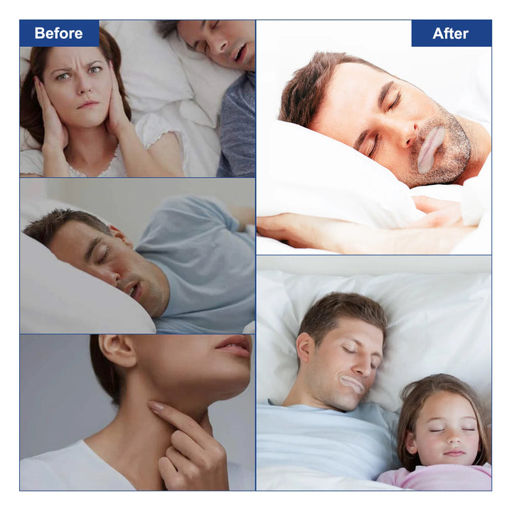 Anti Snoring Nasal Strips — Better Nose Breathing with 1081