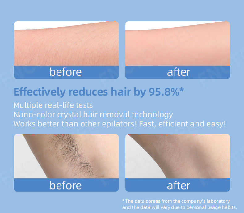 Crystal Glass Epilator for Gentle Body Hair Removal