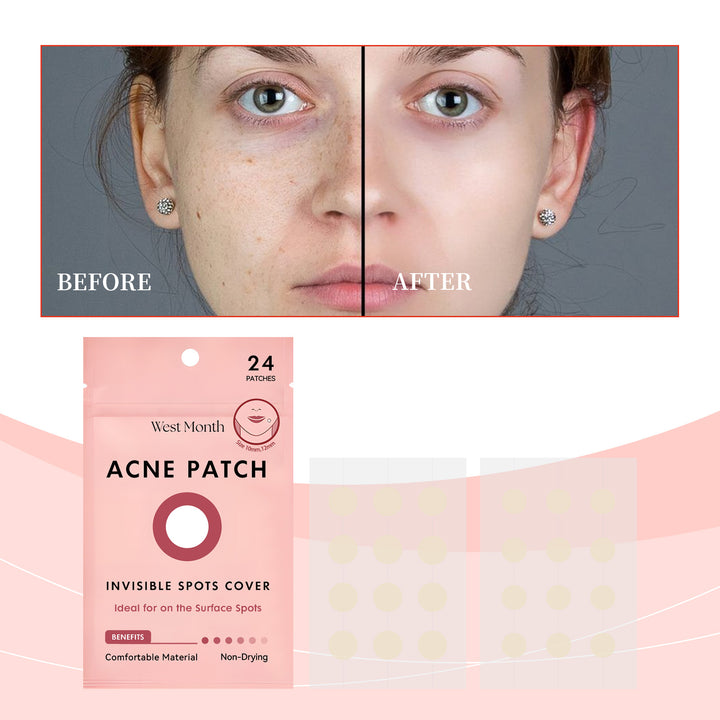 Acne Patches for Invisible Surface Spot Coverage, 24