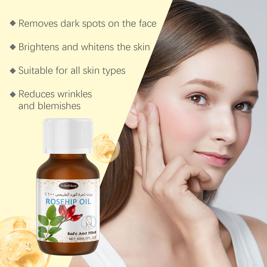 Rosehip Face Oil for Smoother, Softer-Looking Skin