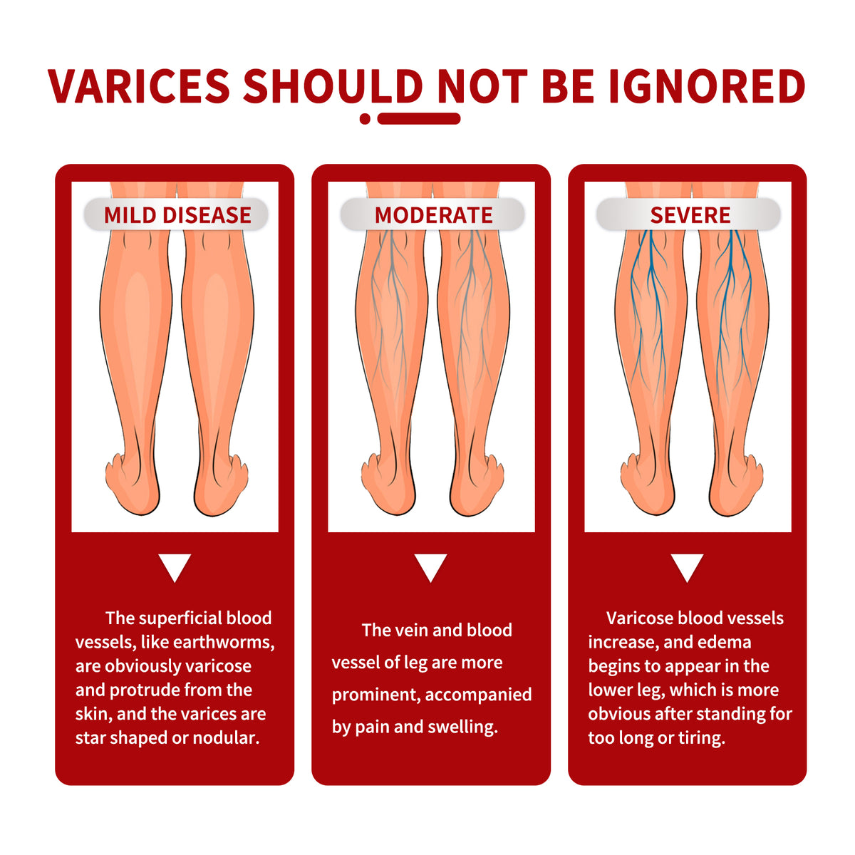 Leg Cream for Warming Massage Care