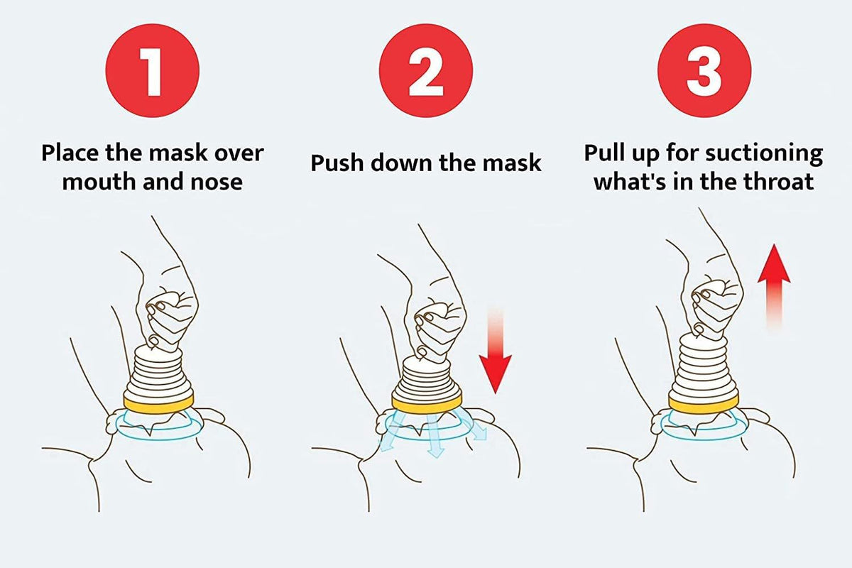 Choking Rescue Device — Strong Suction for Critical Airway