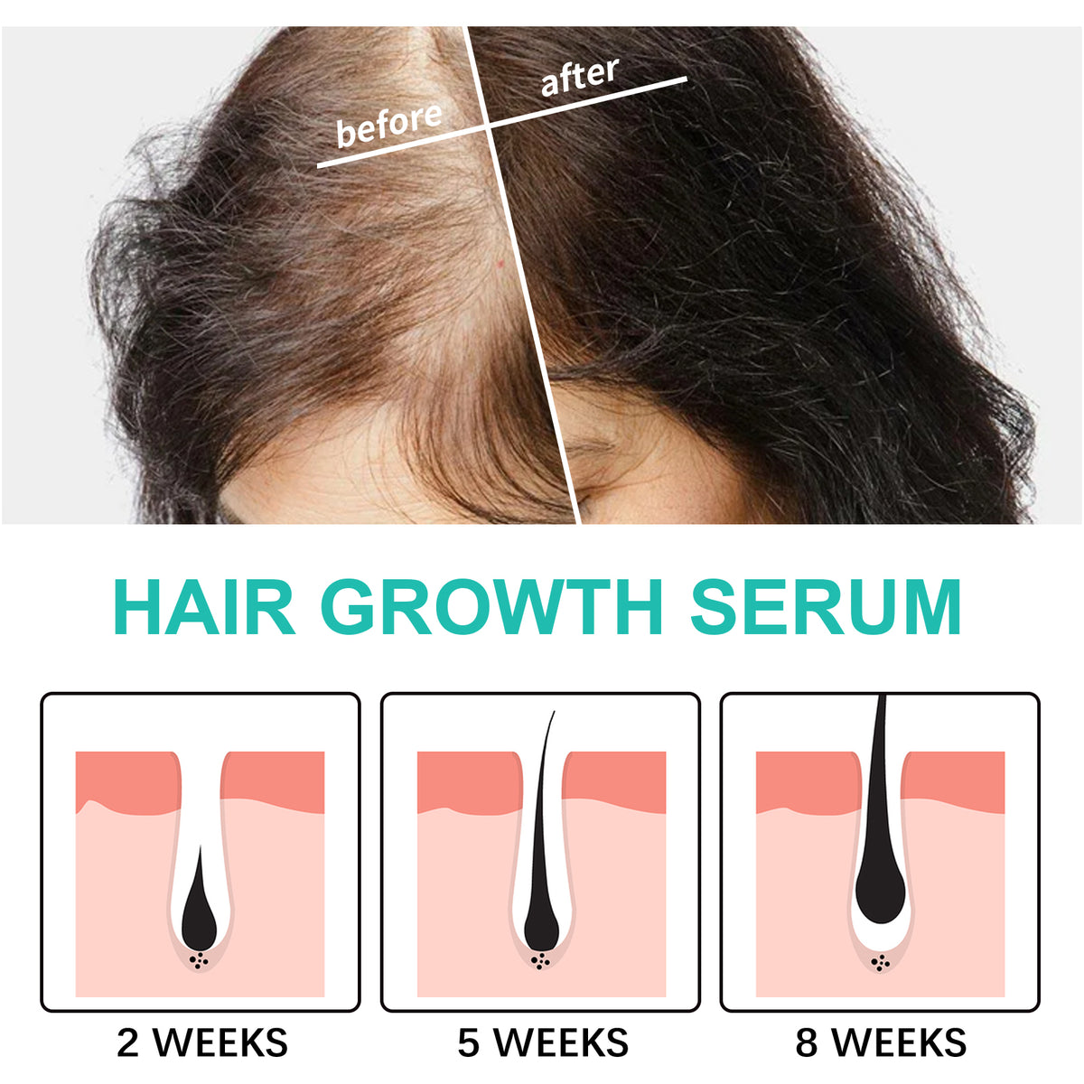 Hair Growth Serum for Fuller, Healthier-Looking Hair