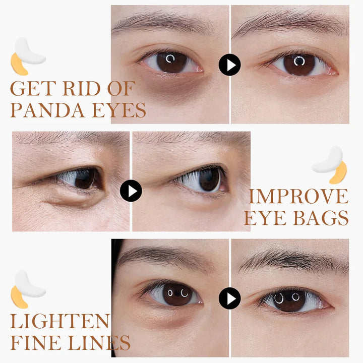 Gold Collagen Eye Patches for Brighter-Looking Eyes