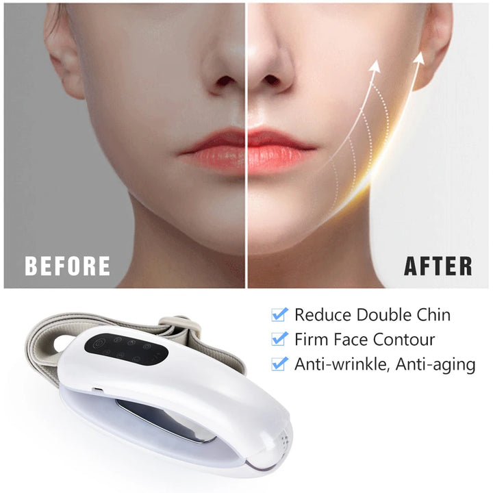Chin V‑Line LED Light Therapy Belt — Visibly Firm