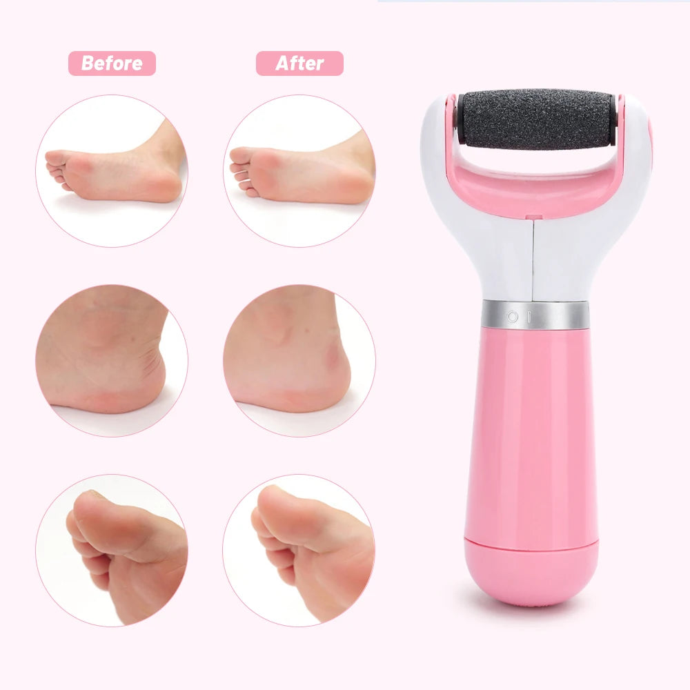 Electric Pedicure Tool – Smooth Heels & Remove Calluses