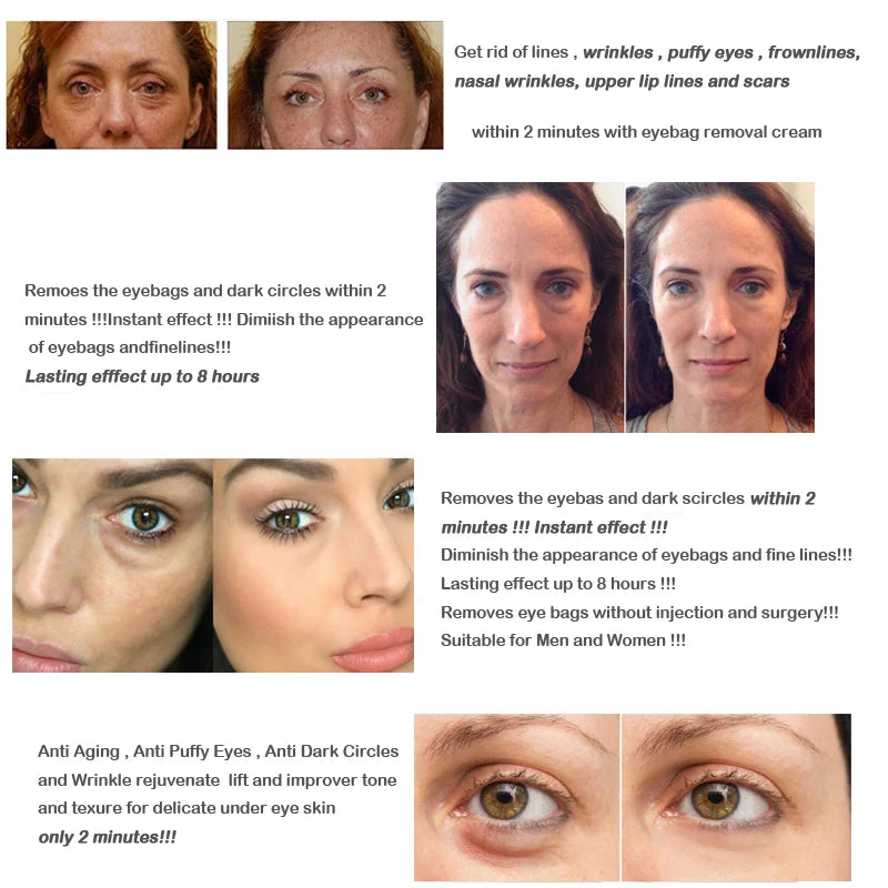 Instant Lifting Eye Cream for Puffiness & Fine Lines