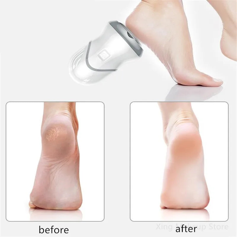 Rechargeable Electric Foot Massager — Portable Relief