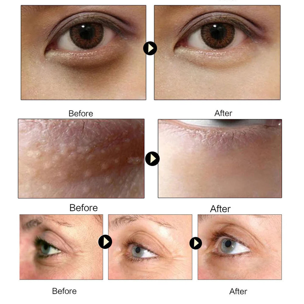 Gold Collagen Eye Patches for Brighter-Looking Eyes
