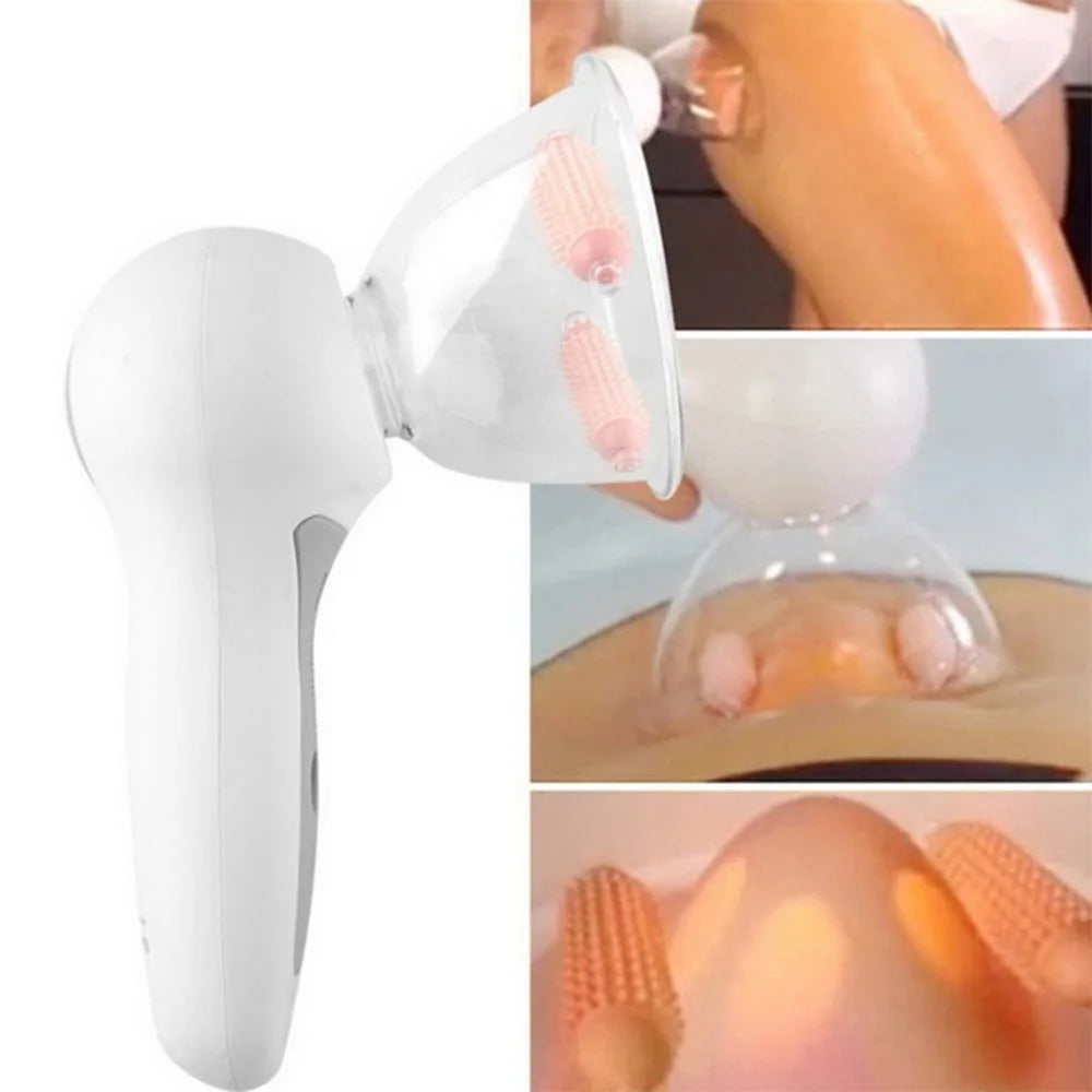 Cellulite Vacuum Cups — Visible Skin Smoothing at Home