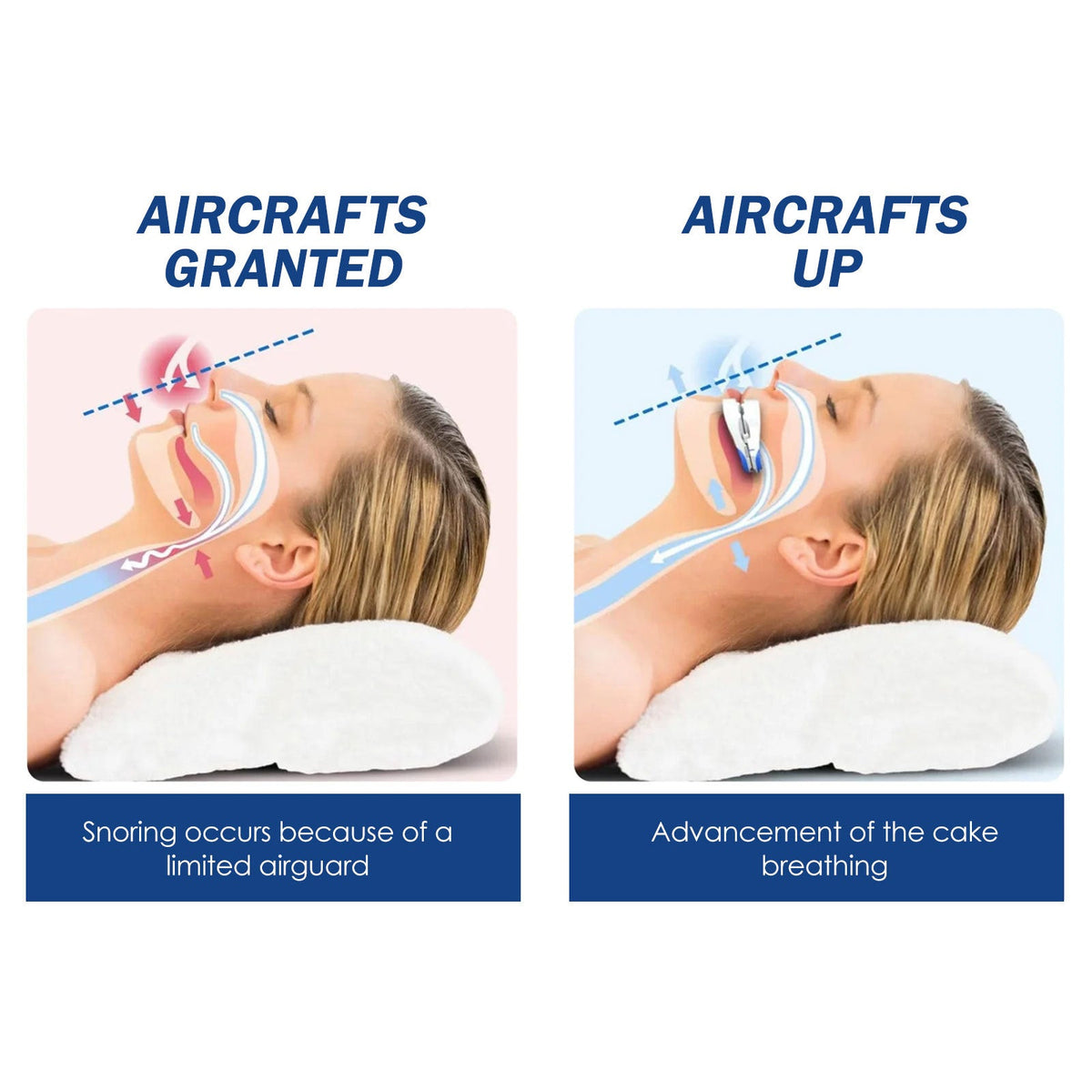 Adjustable Snoring Mouthpiece for Quieter, Calmer Nights
