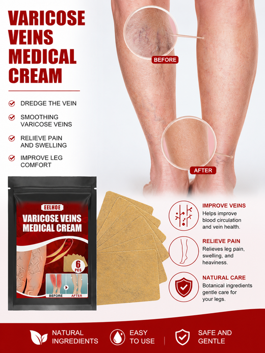 Varicose Vein Cream & Patches — Smoother Legs, Less Swelling