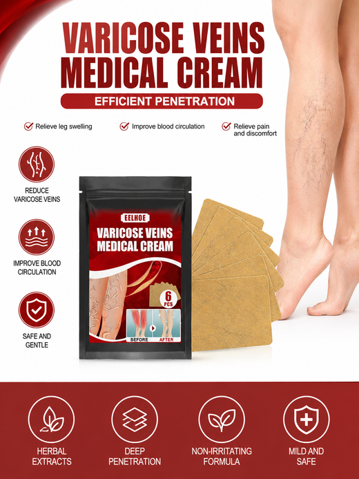 Varicose Vein Cream & Patches — Smoother Legs, Less Swelling