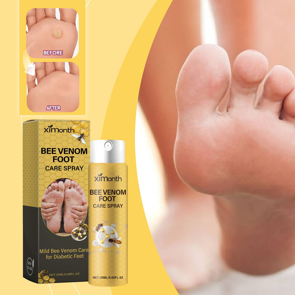 Bee Venom Foot Care Spray for Swollen, Cracked Feet