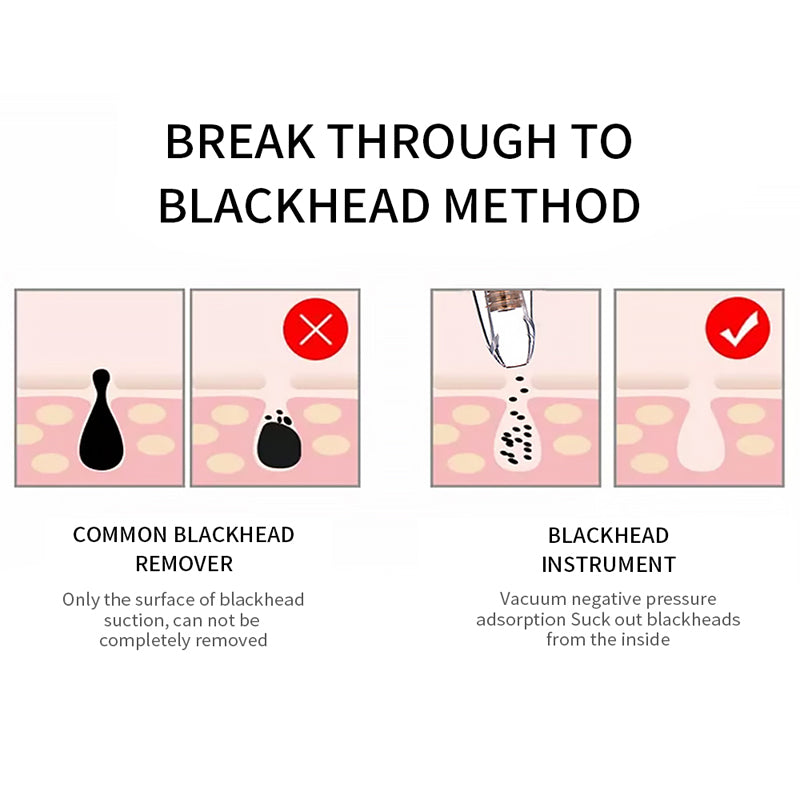 Blackhead Vacuum Pore Cleaner with 3 Suction Heads