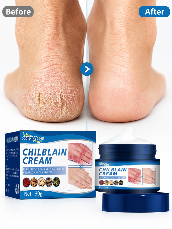 Chilblain Relief Cream – Heals Severe Cracking & Peeling Fast