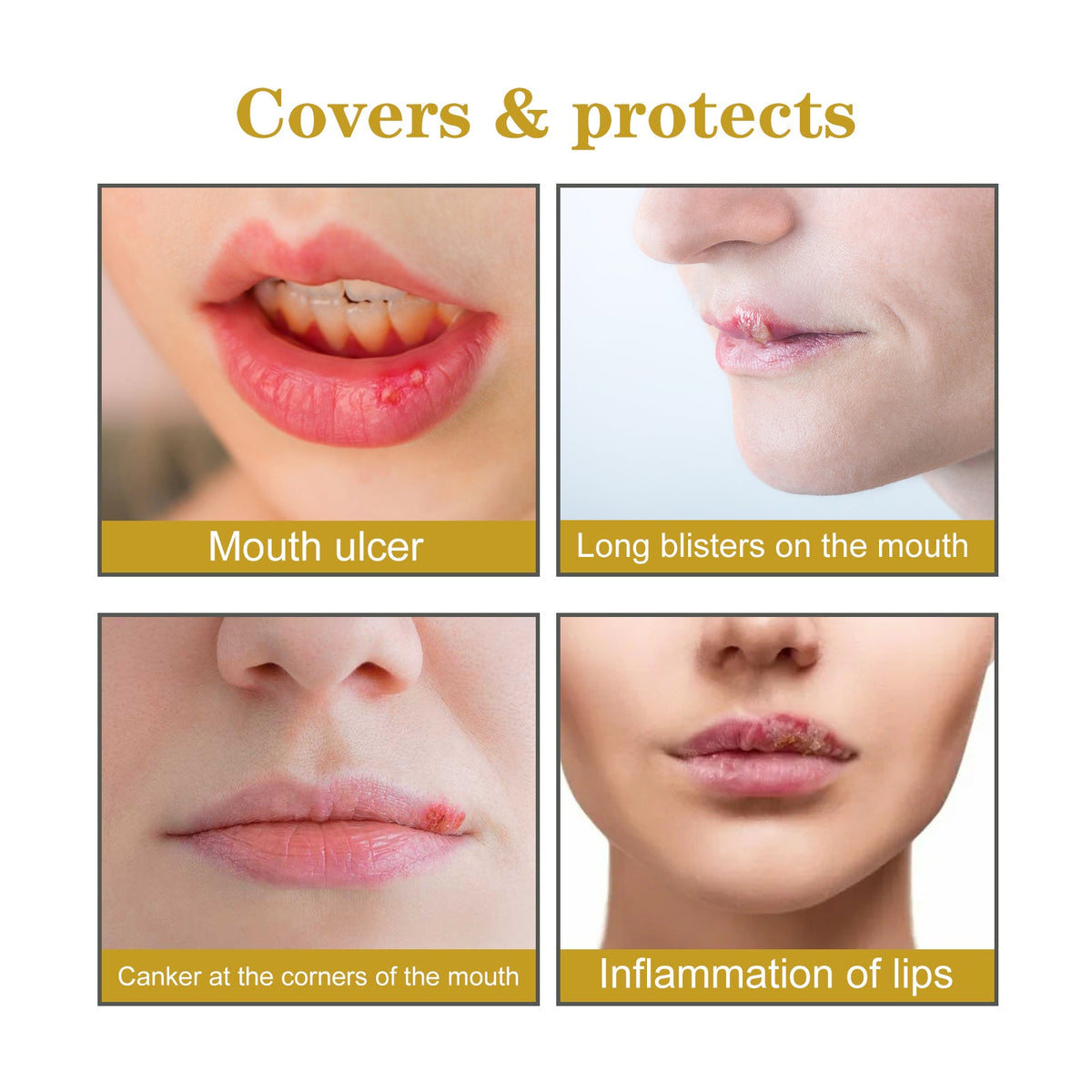 Cold Sore Patches: Invisible Hydrocolloid Lip Cover
